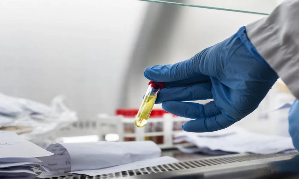 Άρχισε η παραγωγή και του δεύτερου ρωσικού εμβολίου κατά του κορονοϊού